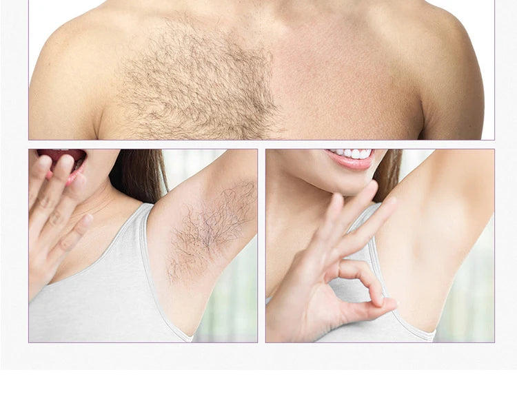Depioladora laser IPL Professional